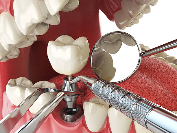 Dentist for Dental Trauma in DE